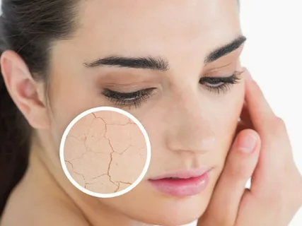 Pele Seca O Que É, Causas e Como Identificar os Sinais